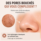 ClearSkin Pro™ - Aspirateur à points noirs