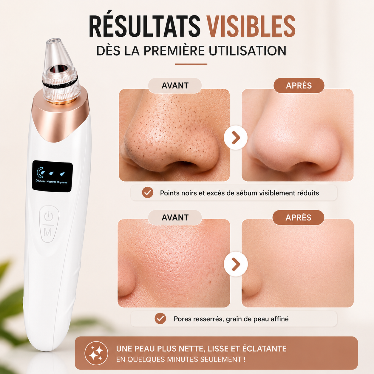 ClearSkin Pro™ - Aspirateur à points noirs